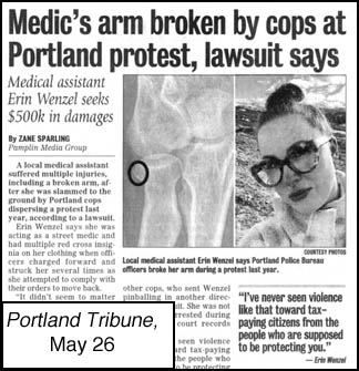 [article image of xray and injured medic from Portland Tribune 
article titled: Medic's arm broken by cops at Portland protest, lawsuit says]